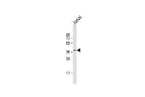 Anti-LEF1 Antibody (N-term) at 1:2000 dilution + Jurkat whole cell lysate Lysates/proteins at 20 μg per lane.