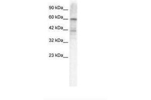 Image no. 1 for anti-Potassium Voltage-Gated Channel, Shal-Related Subfamily, Member 3 (KCND3) (AA 424-473) antibody (ABIN202843) (KCND3 anticorps  (AA 424-473))