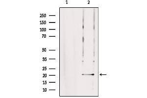 Western blot analysis of extracts from rat brain, using TRAPPC5 Antibody.