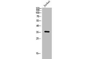 Western Blot analysis of Jurkat cells using Olfactory receptor 6Q1 Polyclonal Antibody