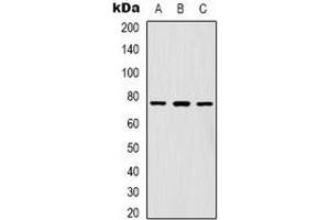 Western blot analysis of FOXK1 expression in Hela (A), A431 (B), Jurkat (C) whole cell lysates.