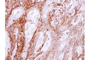 IHC-P Image Immunohistochemical analysis of paraffin-embedded CA922 xenograft, using UBE4B, antibody at 1:500 dilution.