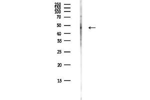 Western blot analysis of lysates from COLO205 cells(heat-shock,45 min treatment), using LCHN Antibody at 1/1000 dilution.