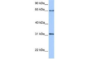 WB Suggested Anti-ZNF394 Antibody Titration:  0. (ZNF394 anticorps  (N-Term))