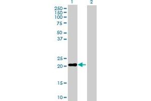 Western Blot analysis of MS4A4A expression in transfected 293T cell line by MS4A4A MaxPab polyclonal antibody. (MS4A4A anticorps  (AA 1-220))