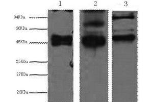 Western Blot analysis of 1) Hela, 2) MCF7, 3) 293T cells using CK-17 Monoclonal Antibody at dilution of 1:2000. (KRT17 anticorps)