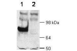 WB - Dab1 Antibody  Immunochemical's anti-Dab1 is shown to detect Dab1 present in wt mouse brain extracts (lane 1). (DAB1 anticorps  (C-Term))