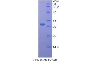 SDS-PAGE analysis of Human Protease, Serine 8 Protein. (Protease Protéine)