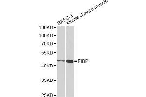 Western blot analysis of extracts of various cell lines, using FIBP antibody. (FIBP anticorps)