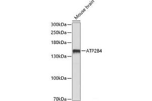 Western blot analysis of extracts of Mouse brain using ATP2B4 Polyclonal Antibody at dilution of 1:1000.
