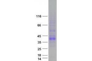 Validation with Western Blot
