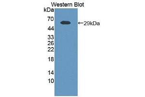 Western blot analysis of the recombinant protein. (NAMPT anticorps  (AA 1-491))
