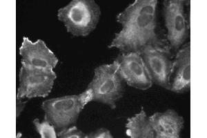 Immunofluorescent staining of A549 (ATCC CCL-185) cells. (PIK3C2B anticorps  (AA 16-209))