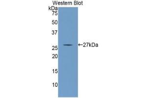 Western blot analysis of the recombinant protein. (ANGPTL1 anticorps  (AA 271-491))