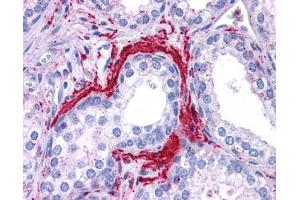 ATG5 antibody was used for immunohistochemistry at a concentration of 4-8 ug/ml. (ATG5 anticorps)