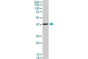 GOT2 polyclonal antibody (A01), Lot # FHC0061120QCS1.