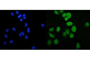 IF analysis of PLTP using anti-PLTP antibody (ABIN7600346). (PLTP anticorps  (AA 18-470))