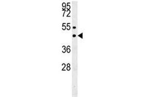 SUV39H1 western blot analysis in MDA-MB435 lysate. (SUV39H1 anticorps  (N-Term))