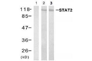 Western blot analysis of extracts from Hela cell and HL60 cell using stat2 (Ab-690) Antibody (E021536, Lane 1, 2 and 3 ) (STAT2 anticorps)