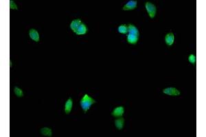 Immunofluorescence staining of MCF-7 cells with ABIN7160220 at 1:400, counter-stained with DAPI.