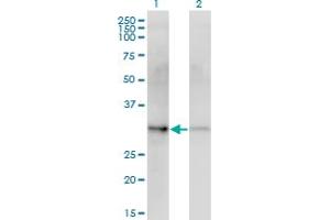 Western Blot analysis of CDK4 expression in transfected 293T cell line by CDK4 monoclonal antibody (M10), clone 1E1. (CDK4 anticorps  (AA 1-303))