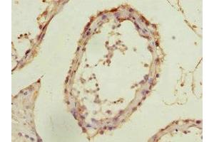 Immunohistochemistry of paraffin-embedded human testis tissue using ABIN7143006 at dilution of 1:100