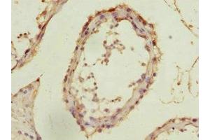 Immunohistochemistry of paraffin-embedded human testis tissue using ABIN7143006 at dilution of 1:100 (FIBP anticorps  (AA 1-364))