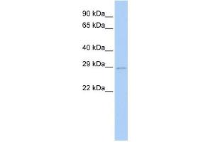 WB Suggested Anti-UBE2S Antibody Titration:  0. (UBE2S anticorps  (N-Term))