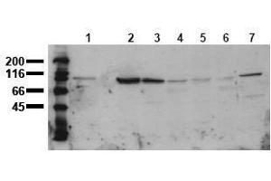 Western Blotting (WB) image for anti-Catenin (Cadherin-Associated Protein), beta 1, 88kDa (CTNNB1) (AA 35-50) antibody (ABIN126744) (CTNNB1 anticorps  (AA 35-50))