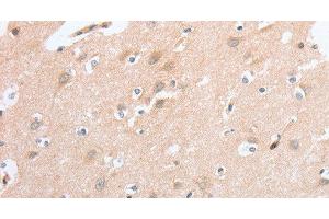 Immunohistochemistry of paraffin-embedded Human brain tissue using SIGLEC9 Polyclonal Antibody at dilution 1:40 (SIGLEC9 anticorps)