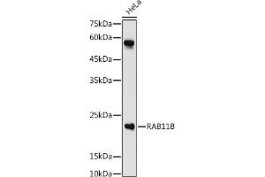 Western blot analysis of extracts of HeLa cells, using RB antibody (ABIN7269795) at 1:1000 dilution. (RAB11B anticorps  (AA 130-215))