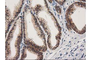 Image no. 3 for anti-Catenin (Cadherin-Associated Protein), beta 1, 88kDa (CTNNB1) antibody (ABIN1496888)