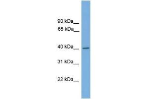 WB Suggested Anti-MAPK1 Antibody Titration: 0. (ERK2 anticorps  (Middle Region))