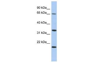 FAM79B antibody used at 1 ug/ml to detect target protein. (TPRG1 anticorps  (N-Term))