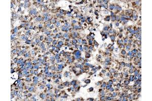 IHC analysis of MRPS25 using anti-MRPS25 antibody (ABIN7599032).