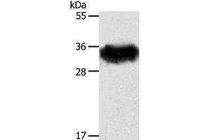 Western Blot analysis of Mouse brain tissue using STX1A Polyclonal Antibody at dilution of 1:600 (STX1A anticorps)