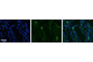 Rabbit Anti-SLCO2B1 Antibody     Formalin Fixed Paraffin Embedded Tissue: Human Lung Tissue  Observed Staining: Membrane in alveolar type I cells  Primary Antibody Concentration: 1:100  Other Working Concentrations: 1/600  Secondary Antibody: Donkey anti-Rabbit-Cy3  Secondary Antibody Concentration: 1:200  Magnification: 20X  Exposure Time: 0. (SLCO2B1 anticorps  (N-Term))