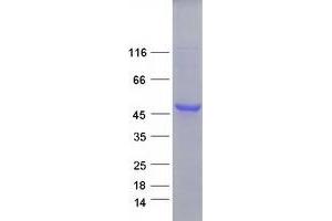 Validation with Western Blot