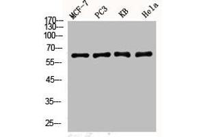 Western Blot analysis of MCF7 PC-3 KB HELA cells using Phospho-YAP (S127) Polyclonal Antibody (YAP1 anticorps  (pSer127))