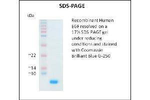 SDS-PAGE (SDS) image for Epidermal Growth Factor (EGF) (Active) protein (ABIN5509294) (EGF Protéine)