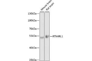 Western blot analysis of extracts of various cell lines, using RTN4RL1 antibody (ABIN6130678, ABIN6147298, ABIN6147299 and ABIN6214124) at 1:1000 dilution. (RTN4RL1 anticorps  (AA 220-420))
