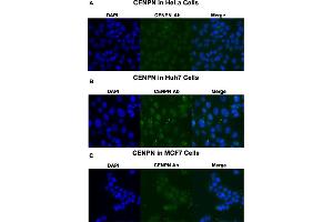 Immunofluorescent staining of HeLa (A), Huh7 (B) and MCF7 (C) cells with CENPN polyclonal antibody  at 1:250 dilution. (CENPN anticorps  (Internal Region))