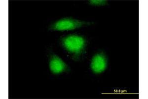 Immunofluorescence of purified MaxPab antibody to OSTF1 on HeLa cell. (OSTF1 anticorps  (AA 1-217))