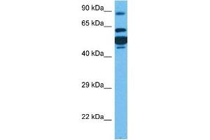 Host:  Rabbit  Target Name:  CPT1A  Sample Tissue:  Human HT1080 Whole Cell  Antibody Dilution:  1ug/ml (CPT1A anticorps  (Middle Region))