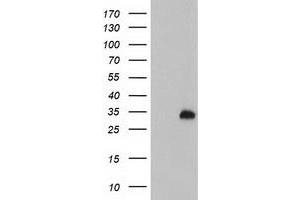 Western Blotting (WB) image for anti-Glutathione S-Transferase omega 2 (GSTO2) antibody (ABIN1498551) (GSTO2 anticorps)