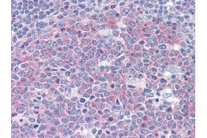 Immunohistochemistry (IHC) image for anti-Phenylalanyl-tRNA Synthetase, beta Subunit (FARSB) (AA 234-342) antibody (ABIN614697)