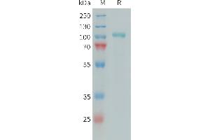Human C1S Protein, His Tag on SDS-PAGE under reducing condition.