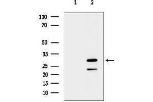 anti-Mitochondrial Ribosomal Protein S2 (MRPS2) (C-Term) antibody