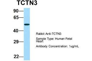 Host:  Rabbit  Target Name:  TCTN3  Sample Type:  Human Fetal Heart  Antibody Dilution:  1. (TCTN3 anticorps  (Middle Region))