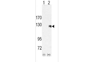 Western blot analysis of ROR2 (arrow) using rabbit polyclonal ROR2 Antibody (C-term) (ABIN392045 and ABIN2841813).